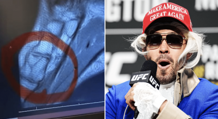 Colby Covington révèle une radiographie de son pied cassé