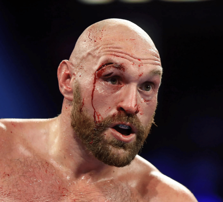 Fury-Usyk reporté suite à la coupure sévère de Fury