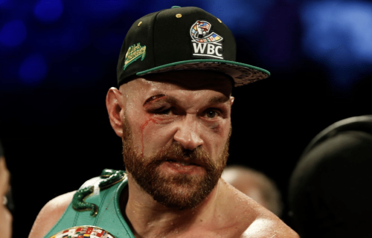 L&rsquo;équipe de Tyson Fury nie avoir une taupe dans le camp