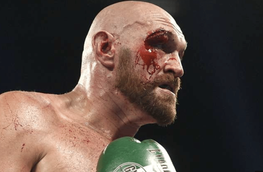 Klitschko dit à Usyk de cibler l'œil de Fury