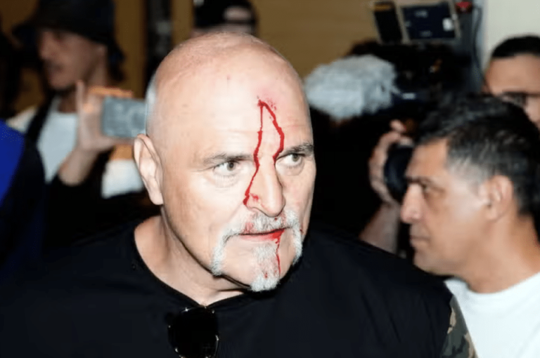 Hatton veut que John Fury réduise son influence dans le coin