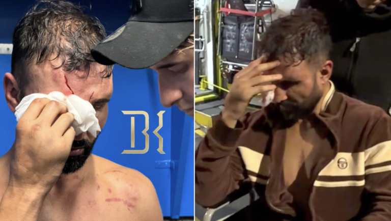 Paulie Malignaggi transportée à l'hôpital après une victoire dans un match de boxe à mains nues