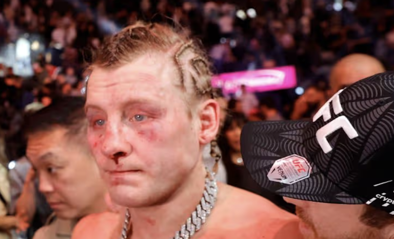 Pimblett aborde sa première défaite à l&rsquo;UFC
