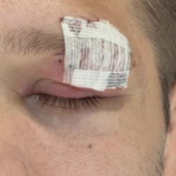 Brian Ortega absent de l&rsquo;UFC 331