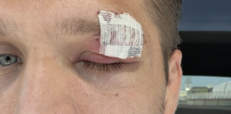 Brian Ortega absent de l&rsquo;UFC 331